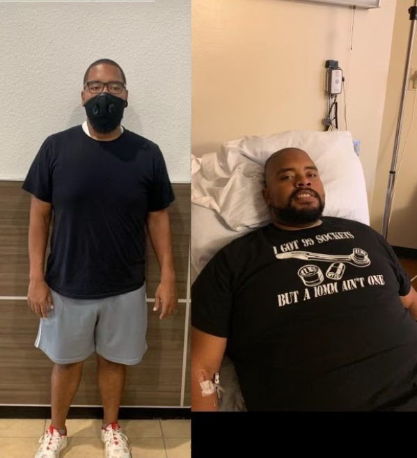 Louis B. — Weight Loss transformation